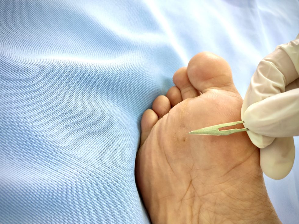 Mountain Spring Podiatry – Culpeper