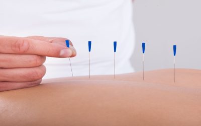 Acupuncture Health Center