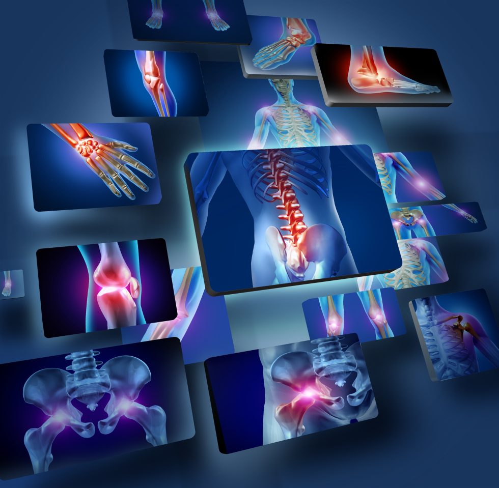 Pinnacle Spine & Neurosurgery – Little Rock